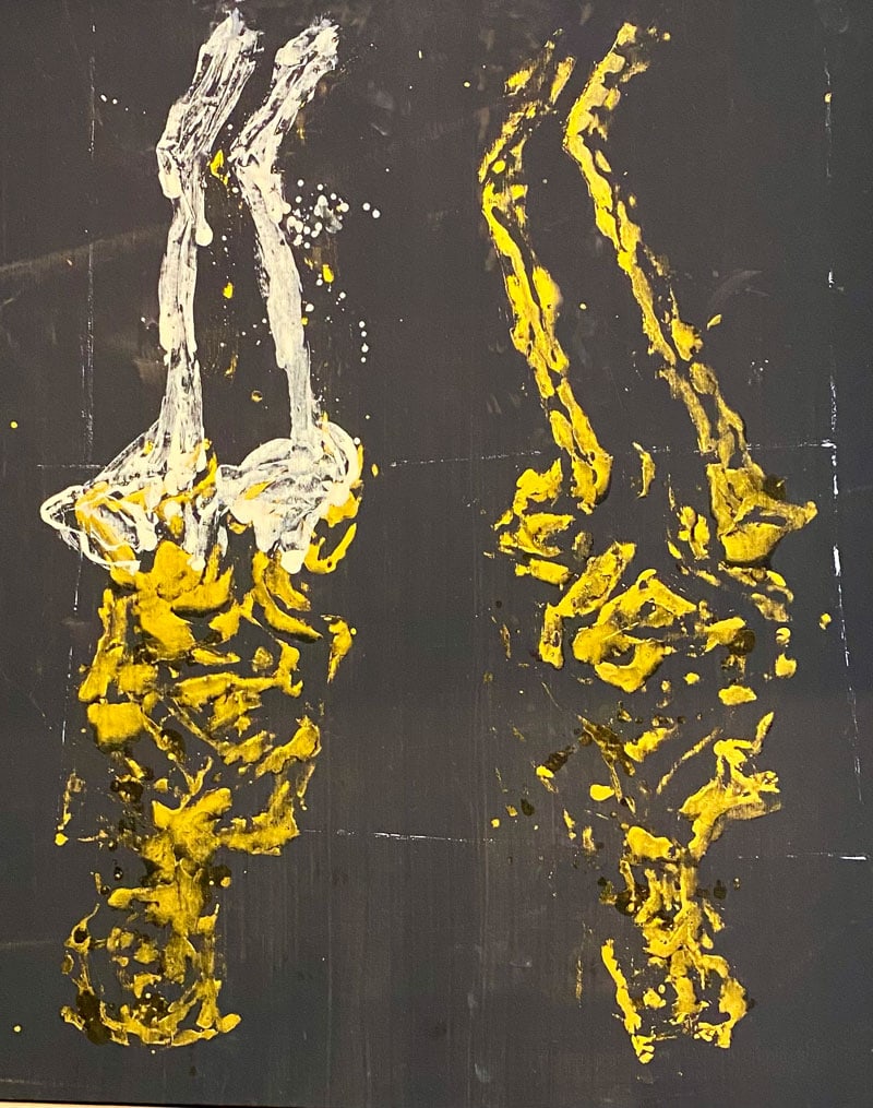 Georg Baselitz